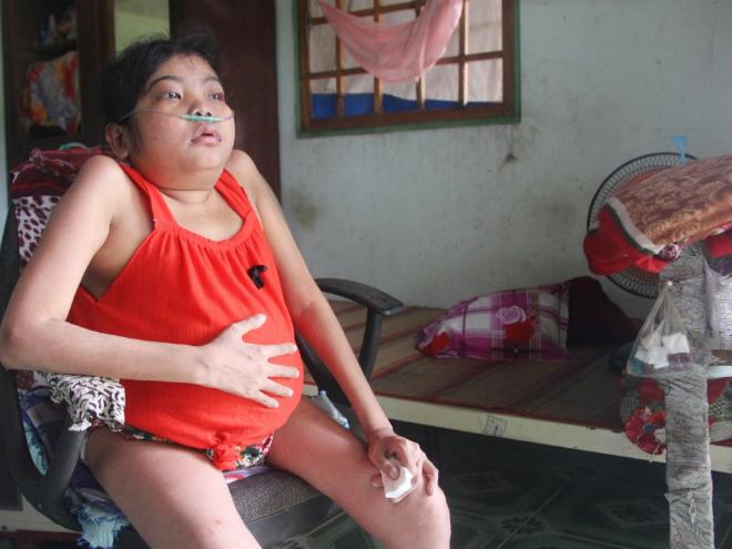 co gai vac chiec bung to tuong suot 12 nam, bi am anh “neu khong truyen mau, no se chet” - 2