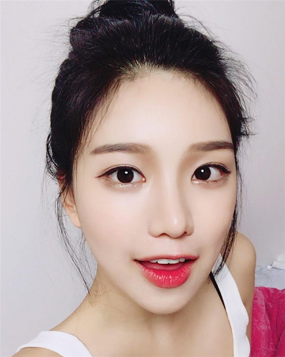 moi kho nut ne ngay dong nho co 5 cach tri nay ma mem mai, cang mong sau 1 dem - 11