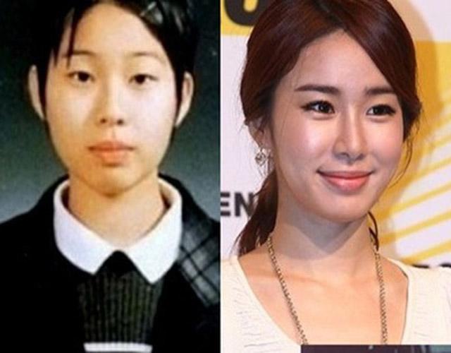 neu khong noi lieu ai se nhan ra cac my nhan nay da dung cham "dao keo" chu? - 11