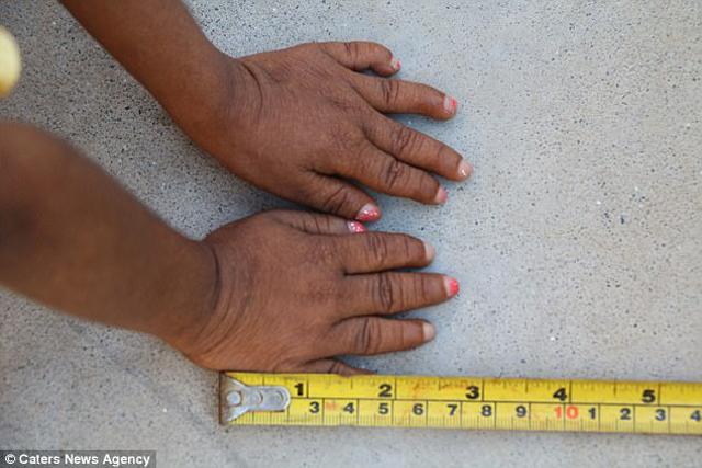 me chi kham thai duy nhat 1 lan, sinh ra con gai mai mai khong bao gio lon duoc - 5