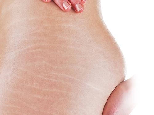 ran da den may cung mo di voi cong thuc than ky tu vien vitamin e va nha dam - 1