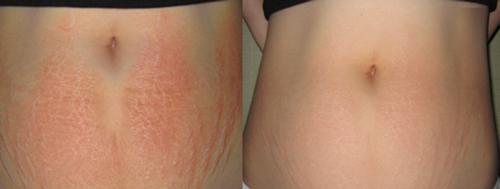 ran da den may cung mo di voi cong thuc than ky tu vien vitamin e va nha dam - 7