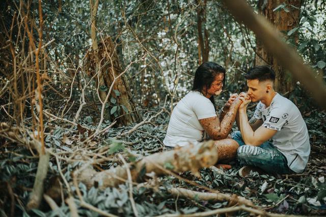 chang trai quyet yeu co gai bi huy hoai dung nhan, minh chung cho cau "tinh yeu luon ton tai" - 9