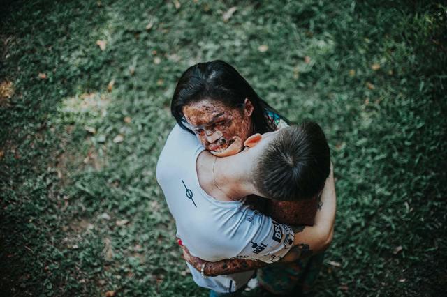 chang trai quyet yeu co gai bi huy hoai dung nhan, minh chung cho cau "tinh yeu luon ton tai" - 11