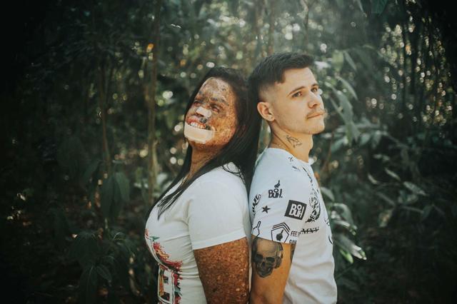 chang trai quyet yeu co gai bi huy hoai dung nhan, minh chung cho cau "tinh yeu luon ton tai" - 6