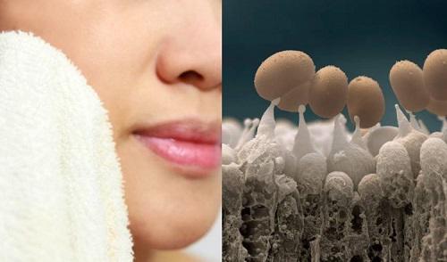 nhung sai lam ngay nao cung mac khien mat ban ngay cang nhieu mun hon - 2