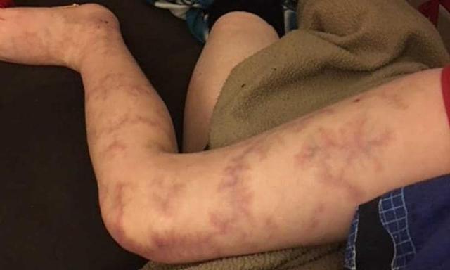 chua kip mung con ra doi, me suyt ngat khi thay chan con bam tim nhu bi danh dap - 3