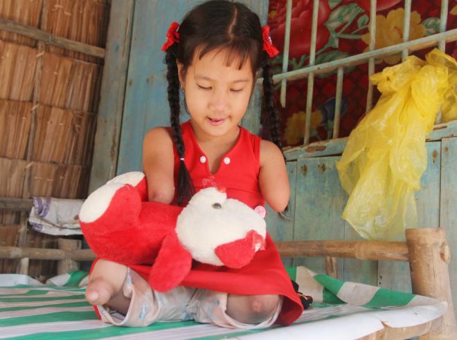 co be “chim canh cut” va cau hoi ngay ngo: “sao me de con ra cut ca chan lan tay” - 4