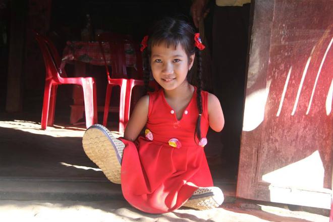 co be “chim canh cut” va cau hoi ngay ngo: “sao me de con ra cut ca chan lan tay” - 1