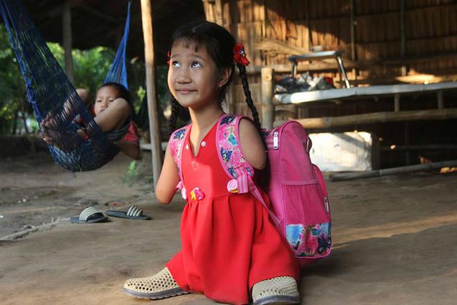 co be “chim canh cut” va cau hoi ngay ngo: “sao me de con ra cut ca chan lan tay” - 5