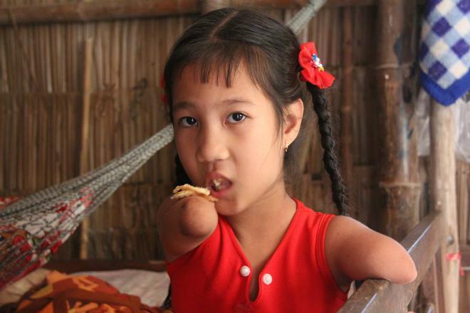 co be “chim canh cut” va cau hoi ngay ngo: “sao me de con ra cut ca chan lan tay” - 3