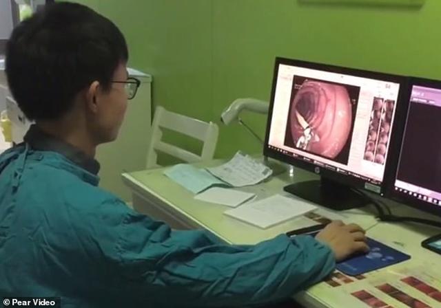 dau bung ca thang tuong bi da day, nguoi phu nu soc nang thay thu khong tuong nay trong nguoi - 1