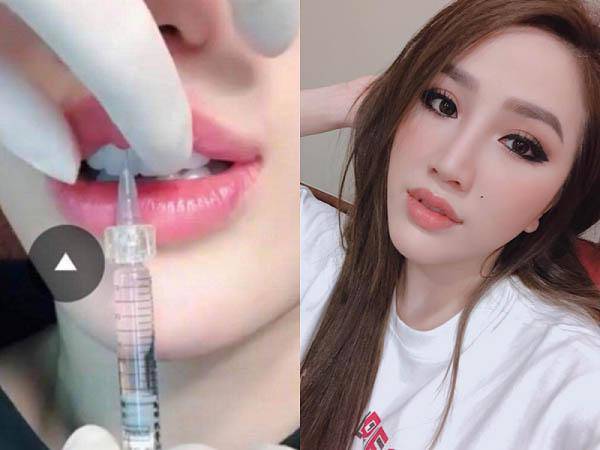 xem chut khong nhan ra bao thy vi guong mat qua khac la nhu phau thuat hong - 11