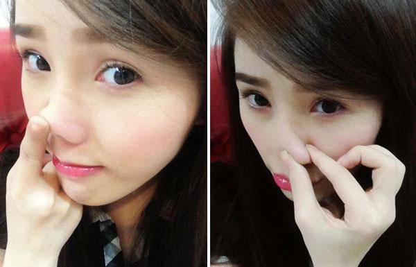 xem chut khong nhan ra bao thy vi guong mat qua khac la nhu phau thuat hong - 13