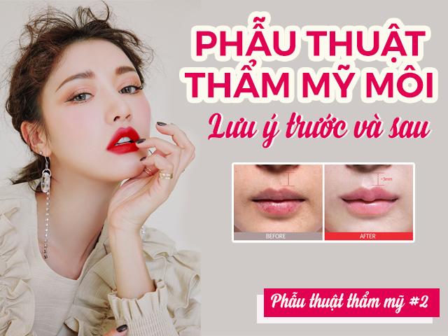 Những lưu ý trước và sau khi phẫu thuật thẩm mỹ môi