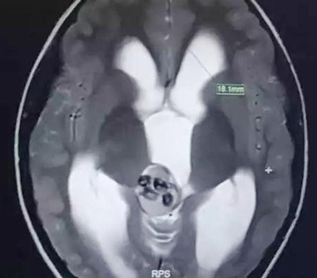 cau be 5 tuoi dau dau du doi, bac si ta hoa phat hien thu kinh di trong nao - 1