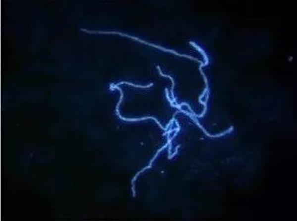 Hai cô gái bị nấm da chỉ vì có chung một sở thích không ít người có - 3