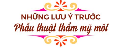 nhung luu y truoc va sau khi phau thuat tham my moi - 2