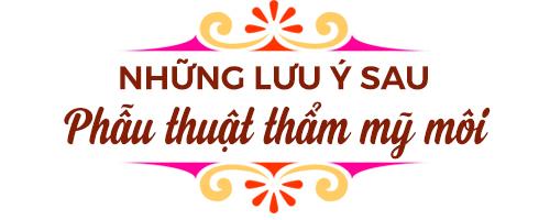 nhung luu y truoc va sau khi phau thuat tham my moi - 4