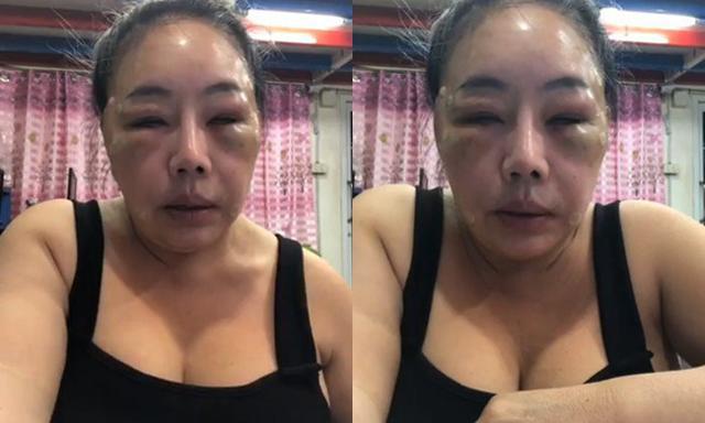 "kieu nu" 'yeu' 28 lan/ngay gay soc voi guong mat xinh dep va thon gon nhu gai doi muoi? - 2