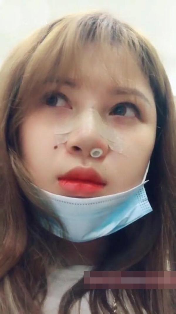 thu nho vong 1, hut 6 lit mo van chua du dep, nu sinh hai duong tiep tuc…nang mui? - 4