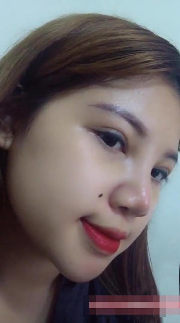 thu nho vong 1, hut 6 lit mo van chua du dep, nu sinh hai duong tiep tuc…nang mui? - 5