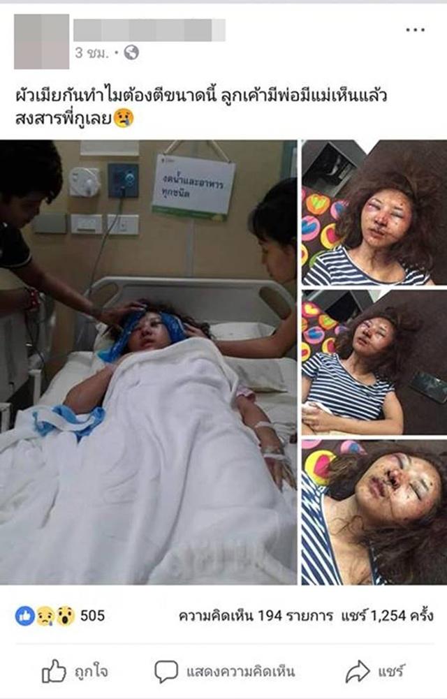 de nguoi yeu cu dua ve nha, vo xinh dep bi chong danh dap den noi khong nhan ra - 1