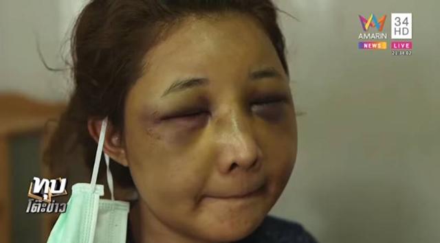 de nguoi yeu cu dua ve nha, vo xinh dep bi chong danh dap den noi khong nhan ra - 4