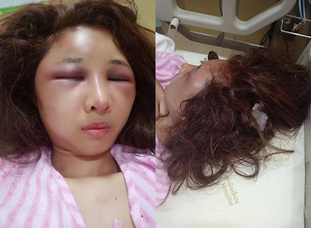 de nguoi yeu cu dua ve nha, vo xinh dep bi chong danh dap den noi khong nhan ra - 3