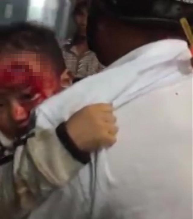 benh vien vang tanh, cha om con mau chay dam dia cho bac si - 1