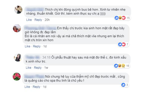 hon 1 tuan troi qua, nhan sac sau dao keo cua "quynh bup be" van dang la de tai hot! - 3