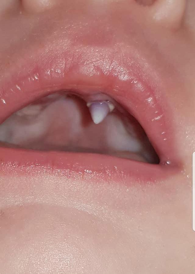 con 11 tuan tuoi bong quay khoc bat thuong, me ta hoa phat dieu khong tuong chi sau 1 dem - 1