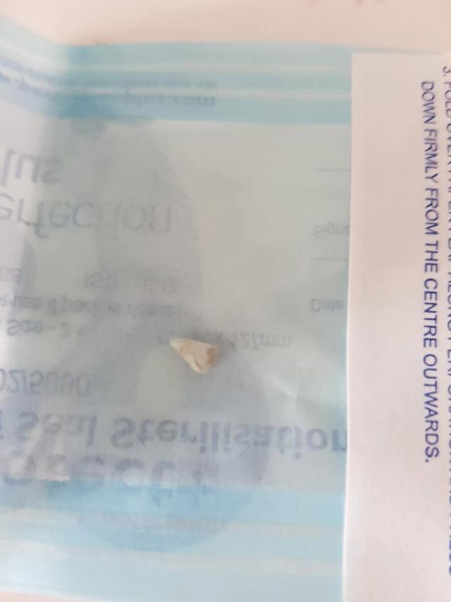 con 11 tuan tuoi bong quay khoc bat thuong, me ta hoa phat dieu khong tuong chi sau 1 dem - 3