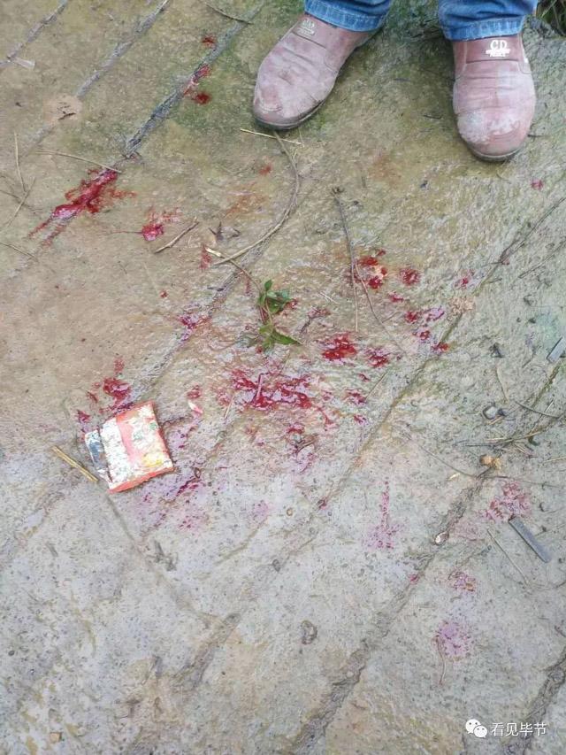 nhan cuoc goi tu nguoi la, bo me chet lang truoc hinh anh con gai trong benh vien - 3