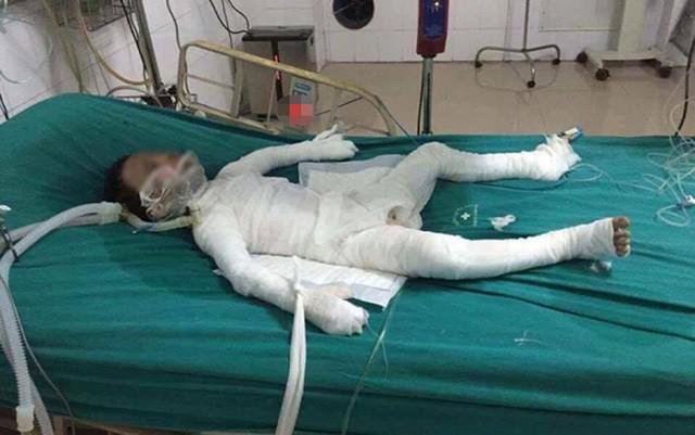 con re phong hoa nha bo vo: truoc luc qua doi, be trai 6 tuoi van hoi tham cha duong - 1