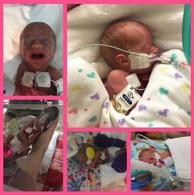 be gai sinh som 14 tuan trong doan clip rung dong hang trieu dan mang gio ra sao? - 1