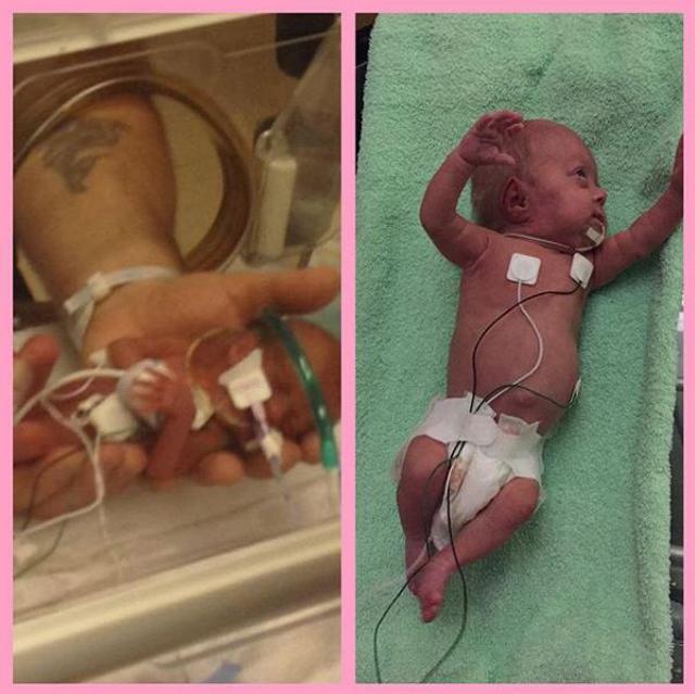 be gai sinh som 14 tuan trong doan clip rung dong hang trieu dan mang gio ra sao? - 3