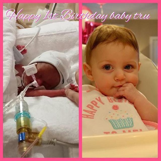 be gai sinh som 14 tuan trong doan clip rung dong hang trieu dan mang gio ra sao? - 7