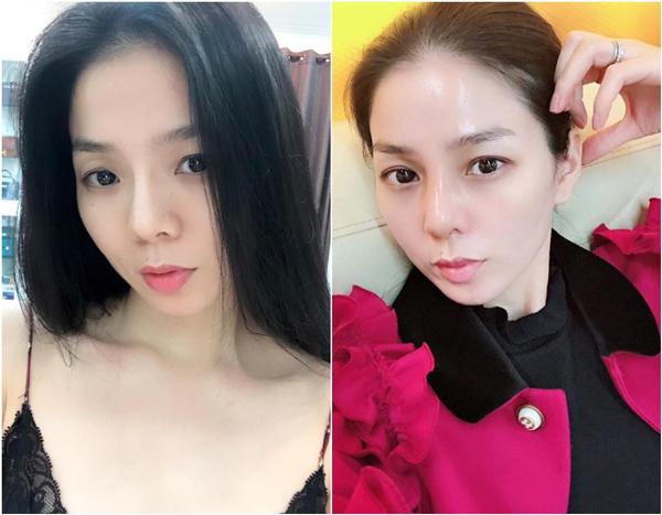 moi dang anh xinh dep, le quyen bi soi nhan sac cung do nghi ngo phau thuat tham my - 4