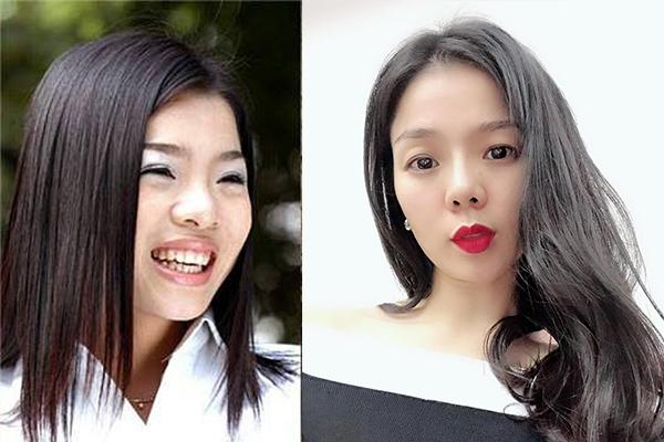 moi dang anh xinh dep, le quyen bi soi nhan sac cung do nghi ngo phau thuat tham my - 7