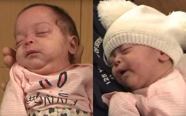 hanh trinh vuot "cua tu" cua be gai sinh non truoc 13 tuan, nang von ven 0,45kg - 5