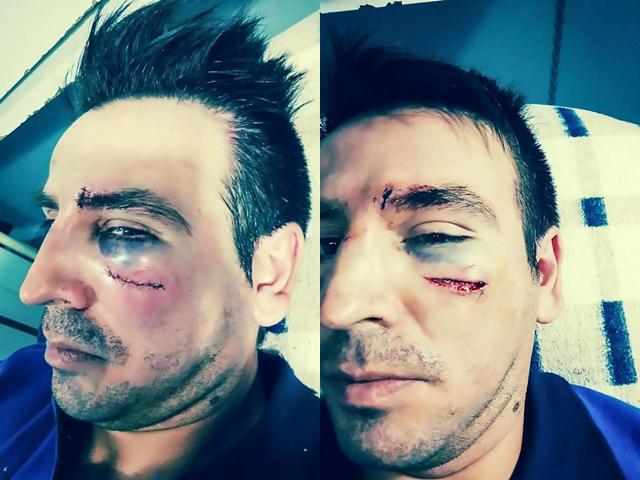 nghi con gai 15 tuoi bi lam dung tinh duc, bo den truong tan cong thay giao da man - 3