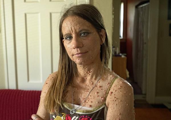 dung cam cat bo 6000 u thit, ca the gioi bat ngo ve nhan sac cua nguoi phu nu nay - 1