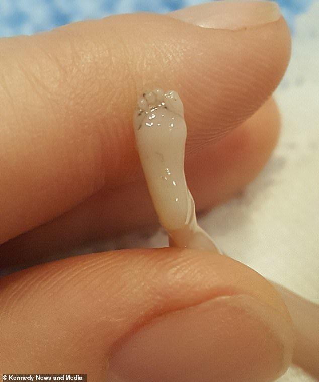 dang anh thai nhi 14 tuan du hinh hai, nguoi me lam rung dong hang trieu nguoi xem - 5