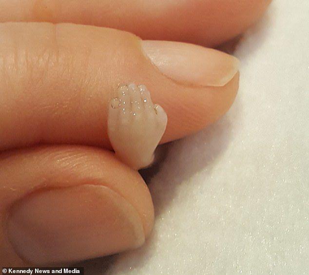 dang anh thai nhi 14 tuan du hinh hai, nguoi me lam rung dong hang trieu nguoi xem - 6