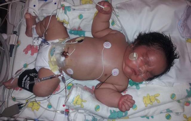 be trai chao doi voi can nang 7.3 kg, bac si van than nhien: "day la con chua du ngay" - 1