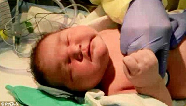 be trai chao doi voi can nang 7.3 kg, bac si van than nhien: "day la con chua du ngay" - 2