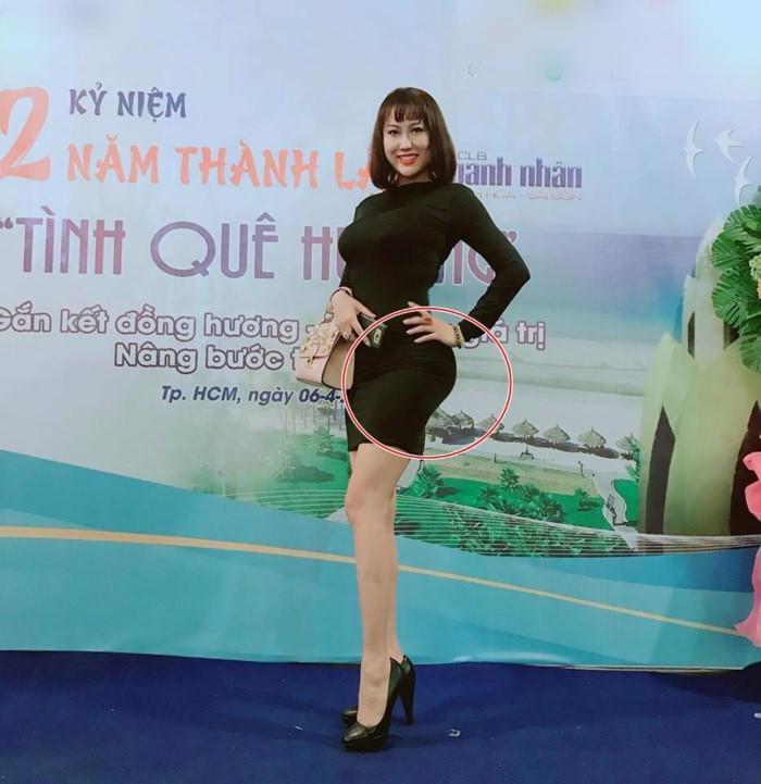 ky luc nhung lan dao keo nghe qua thay thot tim cua cac "nu hoang tham my viet" - 9