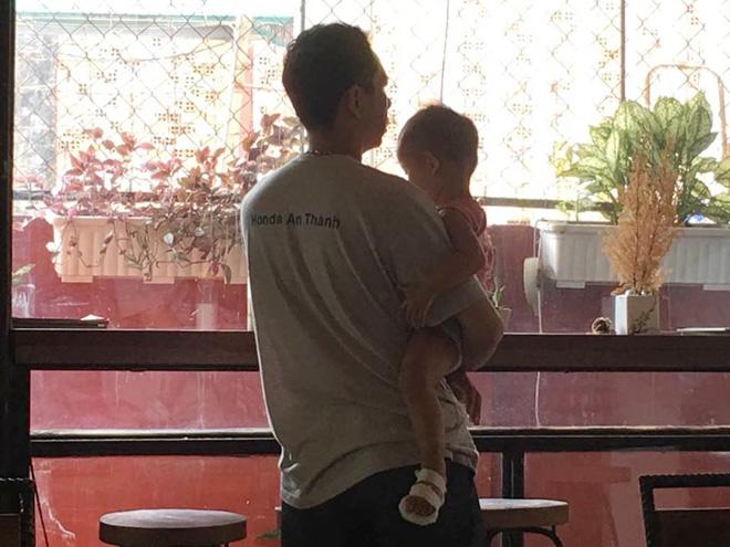 be 18 thang bong bat thuong, co giao: "khong co chuyen chung toi nhung chan be vao nuoc soi" - 2