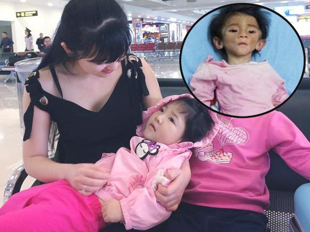 Hình ảnh mới của bé Lào Cai bị suy dinh dưỡng: Ai cũng choáng vì béo bụ bẫm, xinh xắn